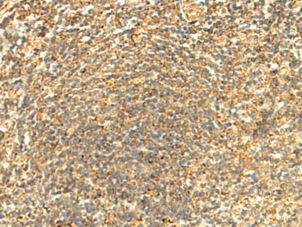 Rabbit Polyclonal Antibody to ABHD10
