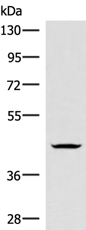 Rabbit Polyclonal Antibody to HMBOX1