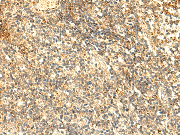 Rabbit Polyclonal Antibody to NAPRT