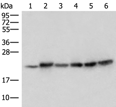 Rabbit Polyclonal Antibody to ATP5PD