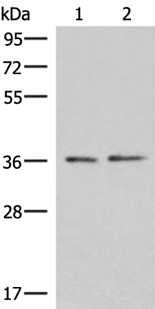 Rabbit Polyclonal Antibody to POLR3F