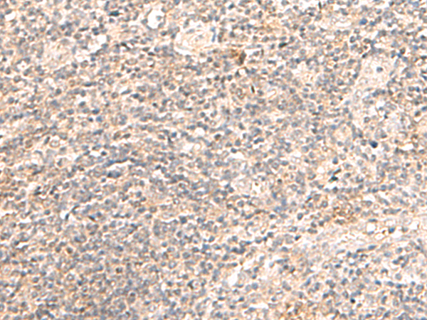 Rabbit Polyclonal Antibody to TRAPPC1