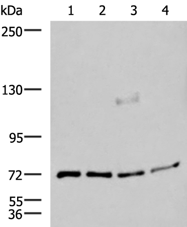 Rabbit Polyclonal Antibody to ASTE1