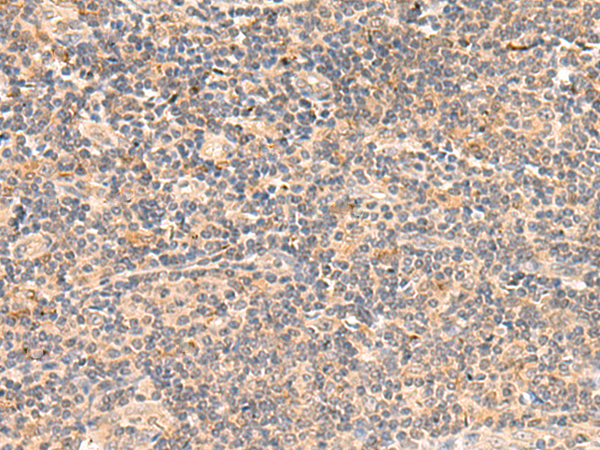 Rabbit Polyclonal Antibody to TEAD3