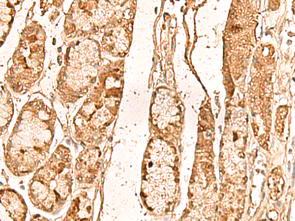 Rabbit Polyclonal Antibody to WDR33