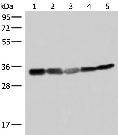 Rabbit Polyclonal Antibody to ECH1
