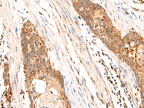 Rabbit Polyclonal Antibody to CYYR1