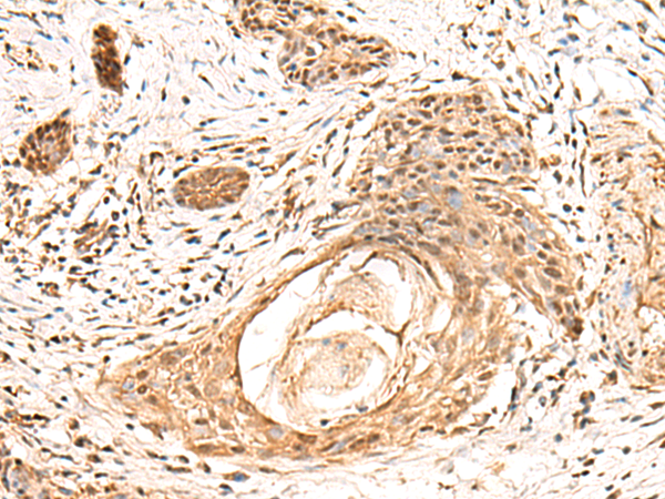 Rabbit Polyclonal Antibody to KCTD13