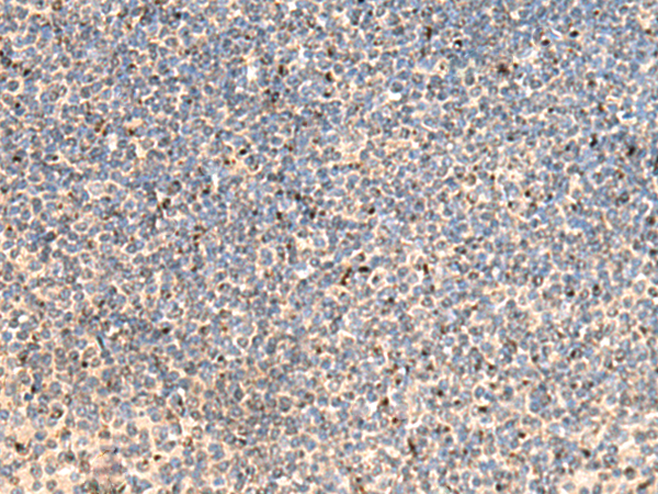 Rabbit Polyclonal Antibody to PTH1R