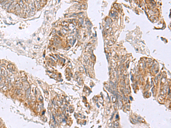 Rabbit Polyclonal Antibody to RTKN2