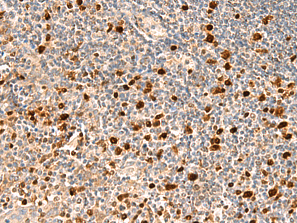 Rabbit Polyclonal Antibody to DUT