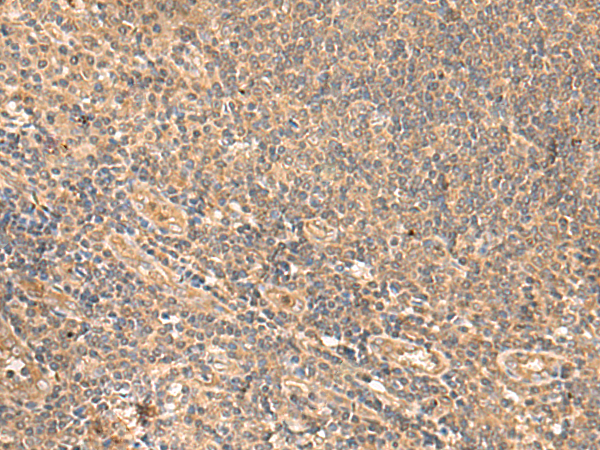 Rabbit Polyclonal Antibody to MEST