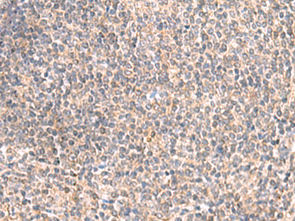 Rabbit Polyclonal Antibody to GIMAP2