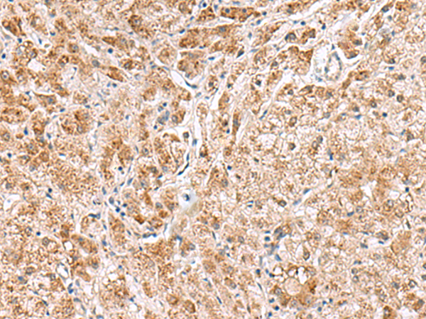 Rabbit Polyclonal Antibody to HMGCLL1