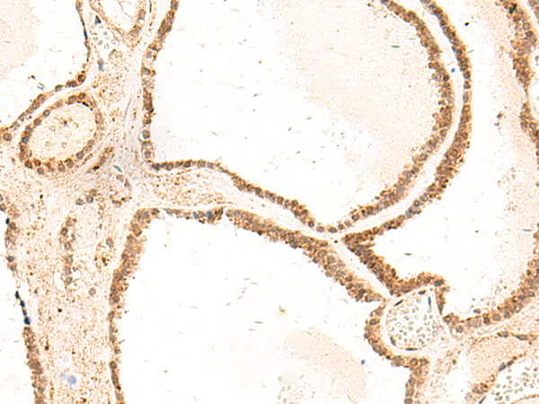 Rabbit Polyclonal Antibody to ZFYVE27