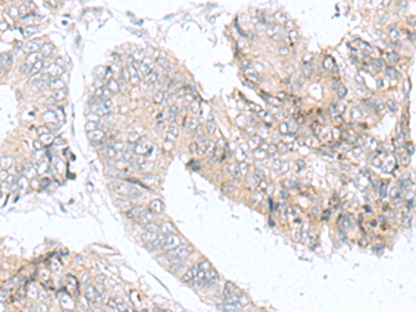 Rabbit Polyclonal Antibody to IQCD
