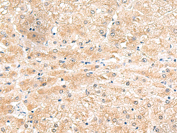 Rabbit Polyclonal Antibody to LRG1