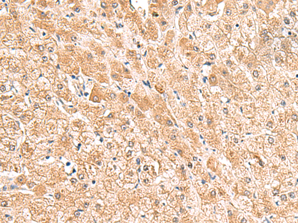 Rabbit Polyclonal Antibody to TRUB1
