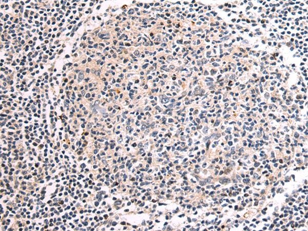 Rabbit Polyclonal Antibody to EIF2B2