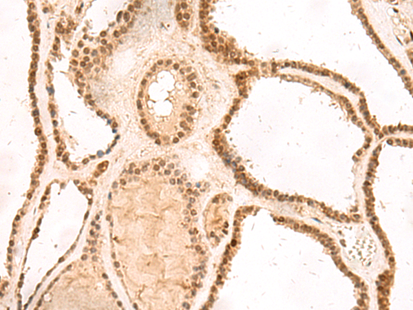 Rabbit Polyclonal Antibody to MKX