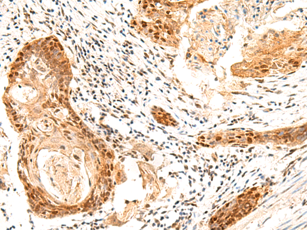 Rabbit Polyclonal Antibody to SETMAR
