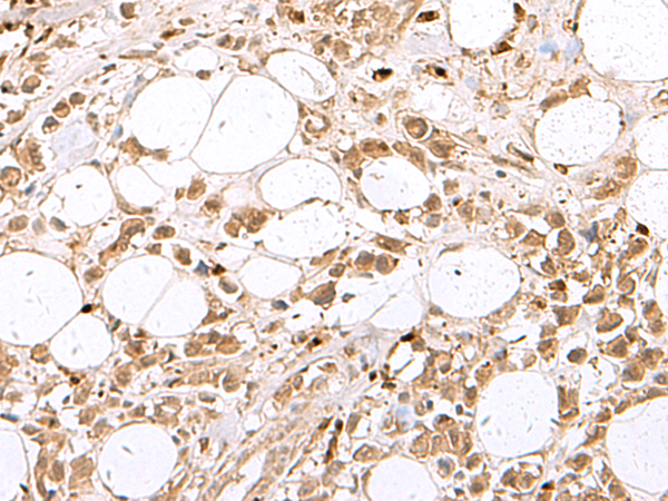 Rabbit Polyclonal Antibody to RBFOX2