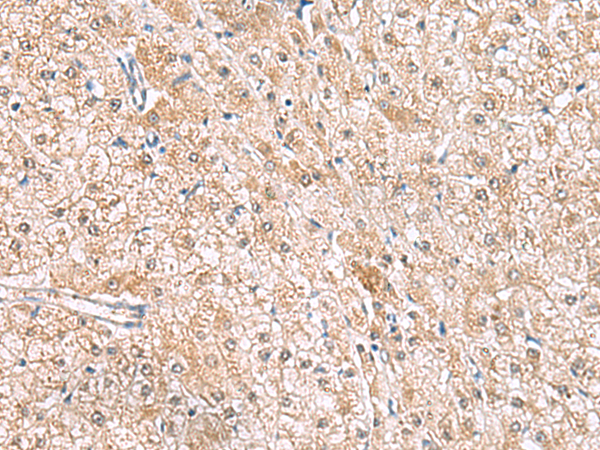 Rabbit Polyclonal Antibody to HLA-E