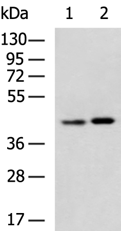 Rabbit Polyclonal Antibody to GMPPB