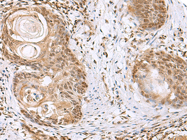 Rabbit Polyclonal Antibody to ELAC1