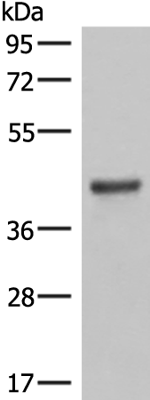 Rabbit Polyclonal Antibody to LMCD1
