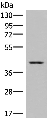 Rabbit Polyclonal Antibody to DHPS