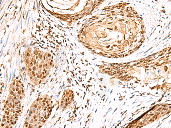 Rabbit Polyclonal Antibody to ELF3