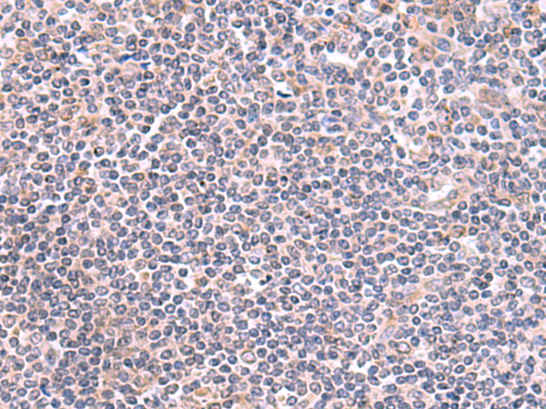Rabbit Polyclonal Antibody to GMDS