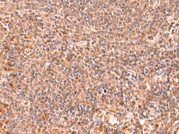 Rabbit Polyclonal Antibody to RABEPK