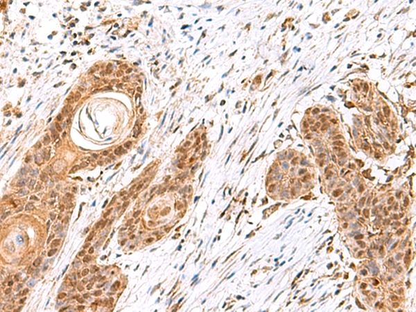 Rabbit Polyclonal Antibody to MECR