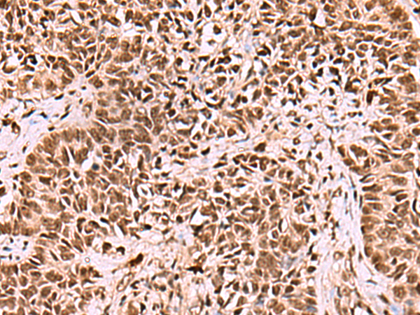 Rabbit Polyclonal Antibody to LDB1