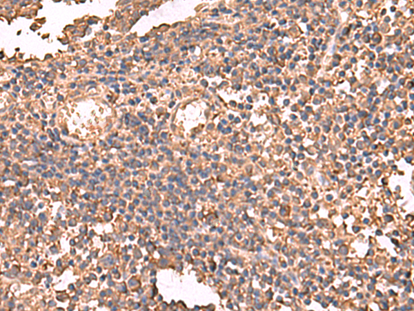 Rabbit Polyclonal Antibody to LDHAL6B