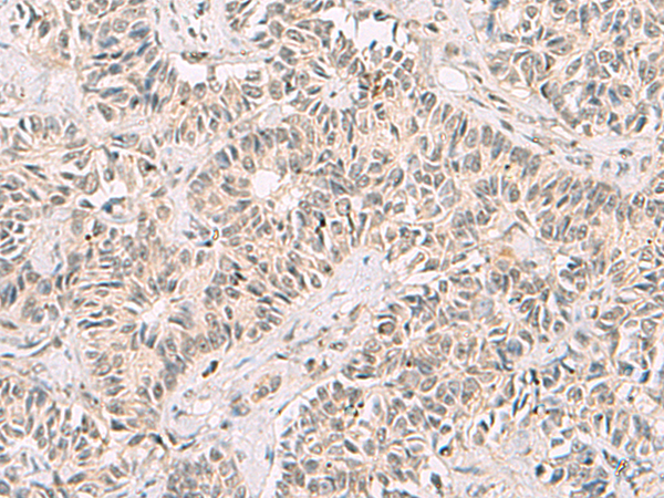 Rabbit Polyclonal Antibody to RNF13