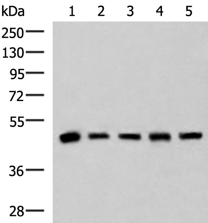 Rabbit Polyclonal Antibody to PCYT2