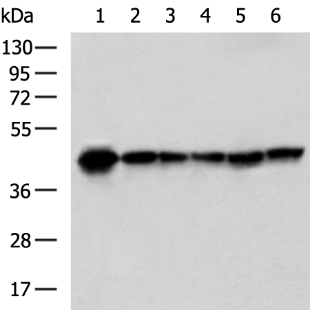 Rabbit Polyclonal Antibody to PDHA1