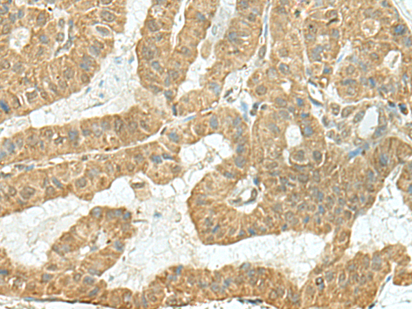 Rabbit Polyclonal Antibody to TENT5C