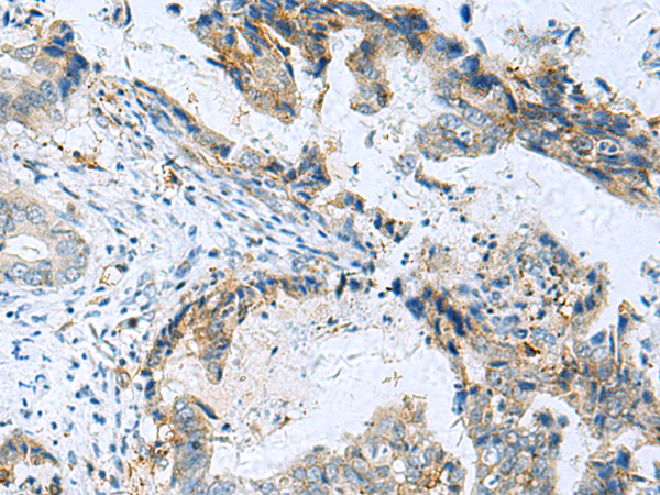 Rabbit Polyclonal Antibody to RMDN2