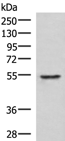 Rabbit Polyclonal Antibody to TUBD1