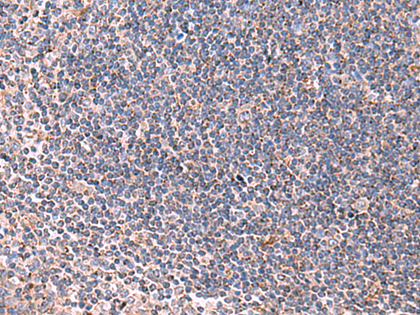 Rabbit Polyclonal Antibody to LIPA