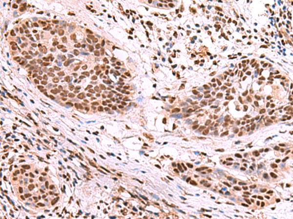 Rabbit Polyclonal Antibody to SF3B3