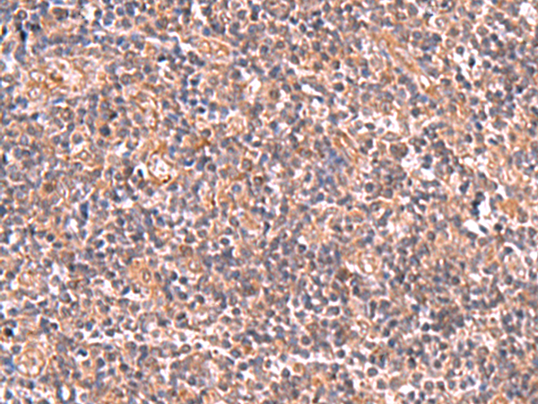 Rabbit Polyclonal Antibody to UBAC1