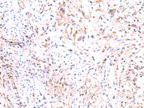 Rabbit Polyclonal Antibody to PHKG2
