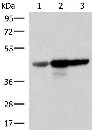 Rabbit Polyclonal Antibody to FDFT1