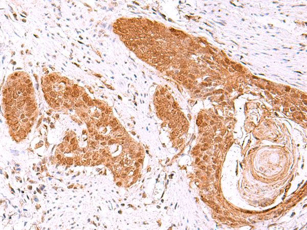 Rabbit Polyclonal Antibody to FDPS