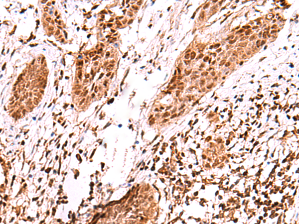 Rabbit Polyclonal Antibody to AK9